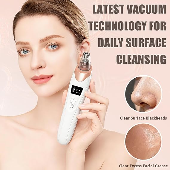 Blackhead Remover – Facial Pore Cleaning & Skincare Tool 🖤✨