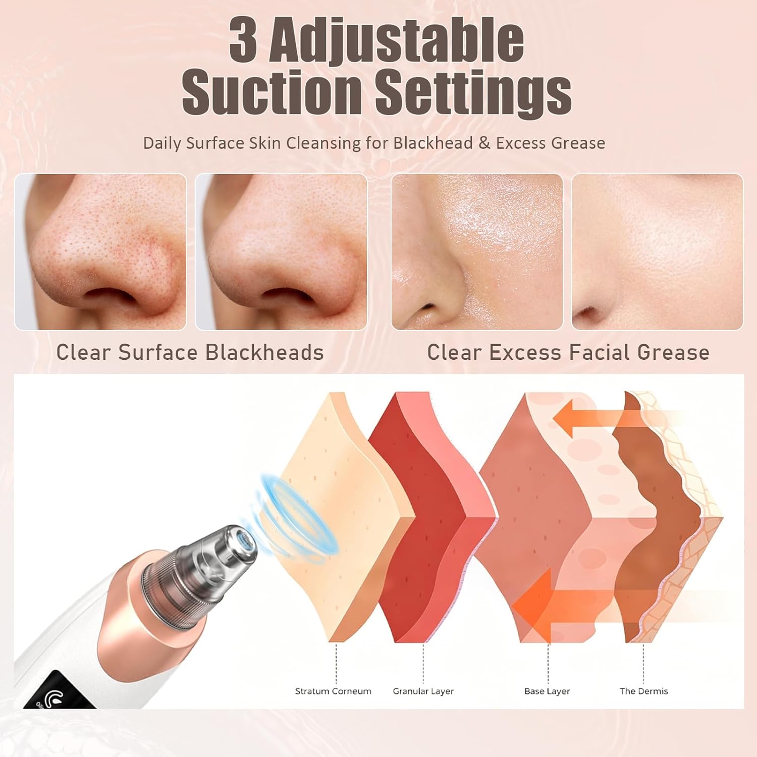 Rechargeable Blackhead Remover Vacuum – Electric Pore Cleaner for Deep Facial Cleansing