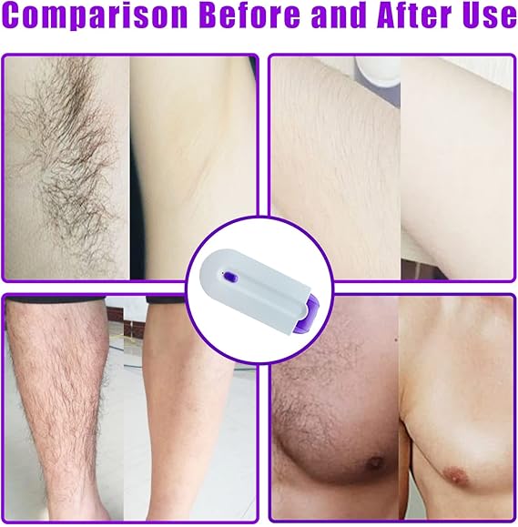 Portable Body Hair Removal Device | Compact Electric Hair Remover for Easy Personal Grooming